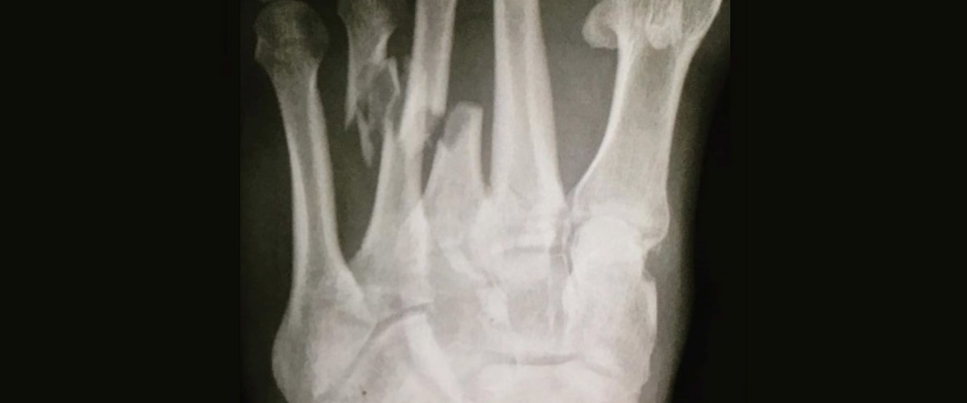 The Importance of Seeking Medical Attention for Foot Injuries