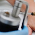 Faster Recovery Tips Inside! Stages of Wart Healing After Freezing Guide